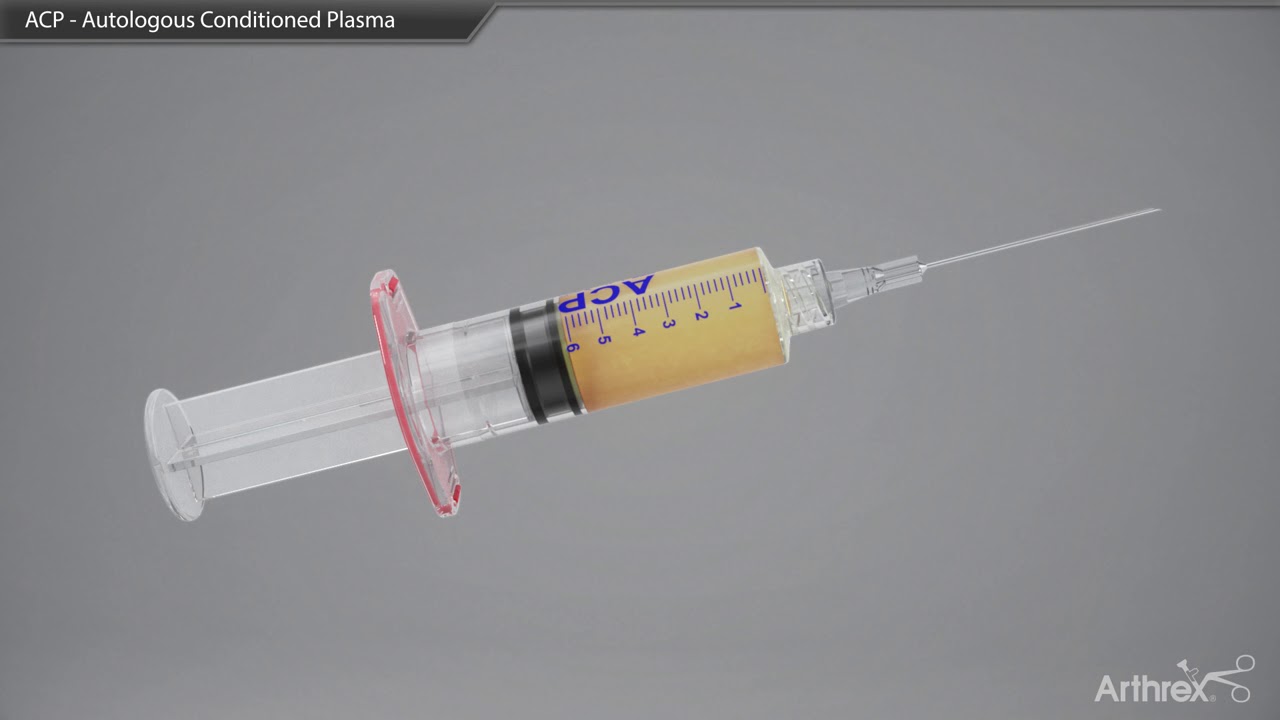 Comment se déroule une injection de PRP Dr Philippe Loriaut