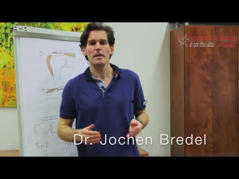 Pool Übungen für zervikale degenerative Bandscheibenerkrankungen Nach Schultergelenk Fraktur warum Arm schmerzt