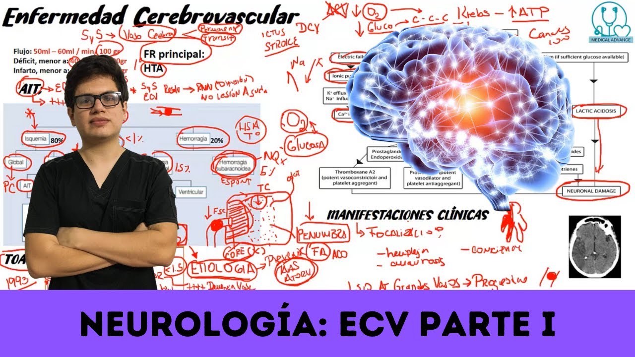 Repaso Neurología: Enfermedad cerebrovascular | Parte 1