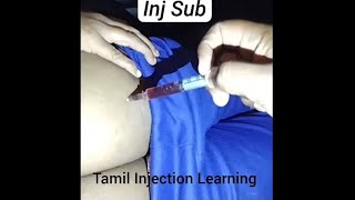 Download lagu Intra Muscular Injection Given to Girl in Car 💉 | Emergency Case mp3 Download lagu Intra Muscular Injection Given to Girl in Car 💉 | Emergency Case mp3