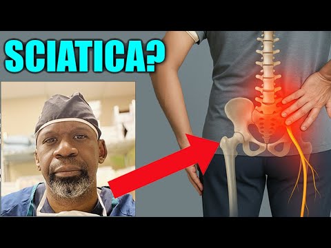 Orthopaedic surgeon explains SCIATICA: its causes, treatment options and exercises to help