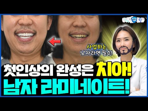 “치아만 바꿨는데 비즈니스가 달라졌다?!” 남자도 라미네이트 해야 하는 이유!