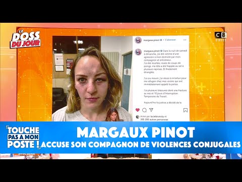 Margaux Pinot, le visage tuméfié, accuse son compagnon de violences conjugales