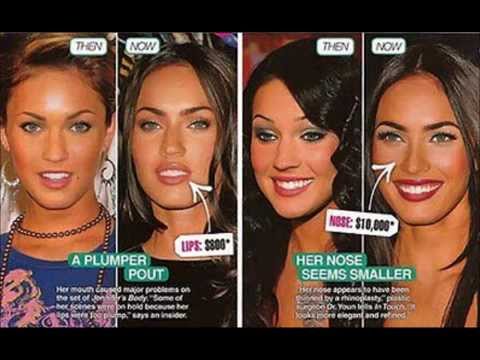 download lagu mp3 mp4 Megan Fox Plastic Surgery, download lagu Megan Fox Plastic Surgery gratis, unduh video klip Megan Fox Plastic Surgery