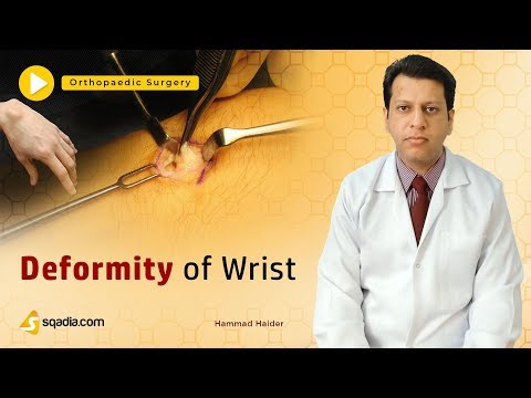 Deformity of Wrist | Orthopedic Surgery Tutorials | Clinical V-Learning | sqadia.com