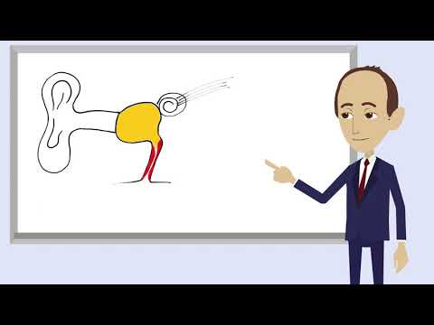 Eustachian Tube Dysfunction Explained