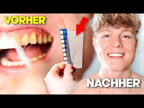 Sofort WEIßE ZÄHNE?! 🦷 Zähne aufhellen zu Hause (Zahnbleaching Selbstexperiment)
