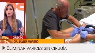 Eliminar varices sin cirugía