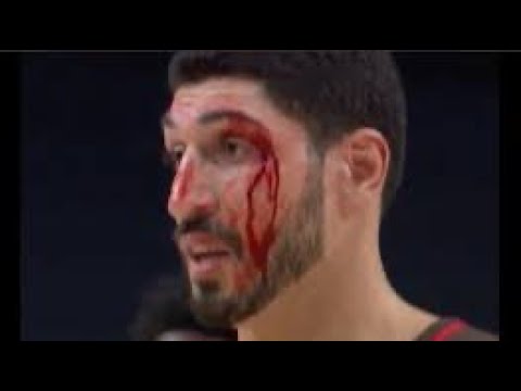 Enes Kanter bloody after elbow to the face 76ers vs Blazers