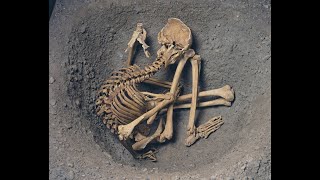 Swollen Members    Park Bench