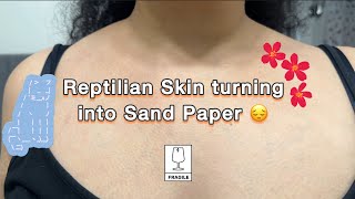 Reptilian Skin turning into Sand Paper 😔 | Curly Cami Channel 