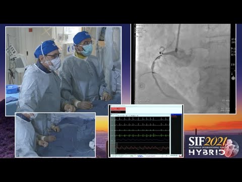 SIF 2021 Live Case #8: How to Treat? Dr. David G. Rizik and Dr. Ashish Pershad