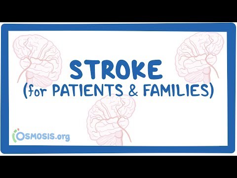 Stroke (for patients & families)