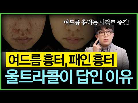 여드름 패인 흉터 완벽 정리 | 울트라콜 원리부터 시술 주기, 효과까지
