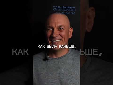 Верни улыбку с имплантами. Александр, 51 год.