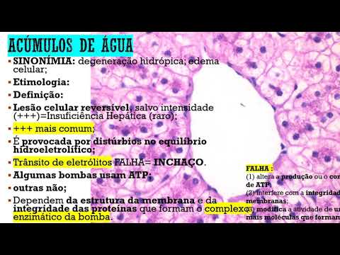 Patologia Geral - Degenerações Hidrópicas e Hialínicas