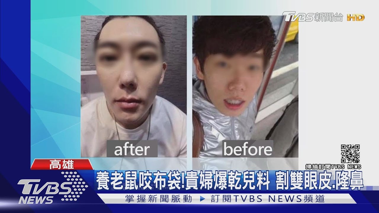 養老鼠咬布袋!貴婦爆乾兒料 割雙眼皮、隆鼻