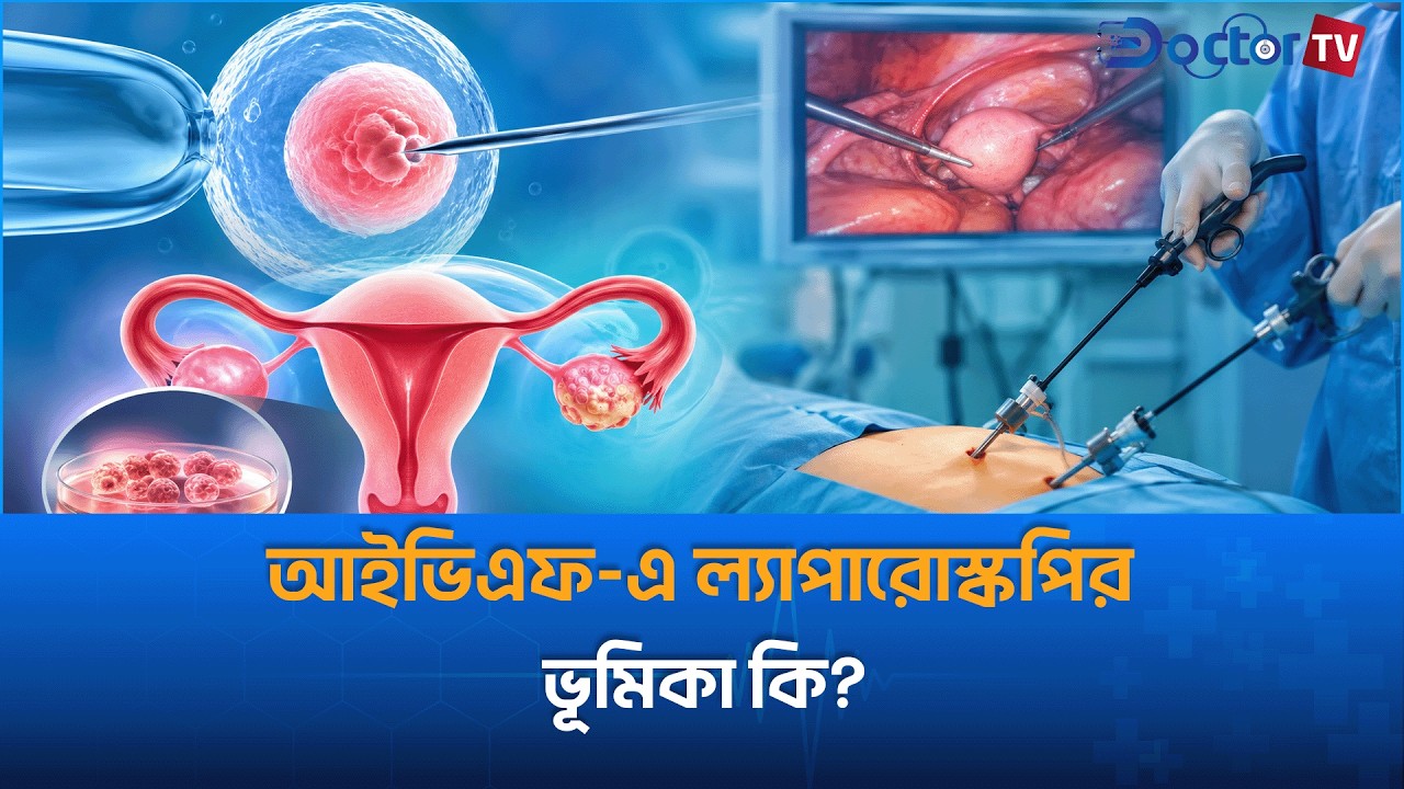 আইভিএফ এ ল্যাপারোস্কপির ভূমিকা কেমন?