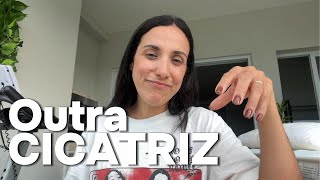 Download lagu I HAD ANOTHER CHEST SURGERY mp3