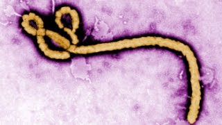 Ebola Drugs in the Works: ZMapp, TKM-Ebola, Brincidofovir