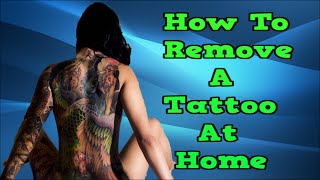 How To Remove A Tattoo At Home, Tattoo Removal Scar, Best Way To Remove A Tattoo, Fade Tattoos