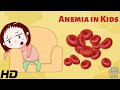 Anemia In Kids Everything You Need To Know