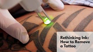 Rethinking Ink: How to Remove a Tattoo