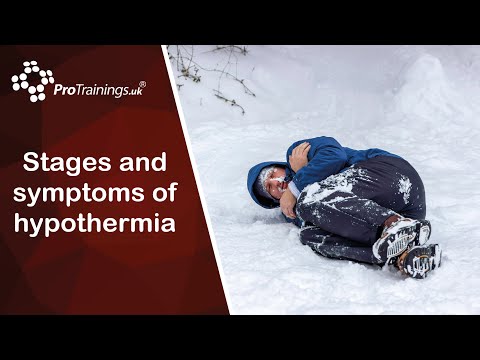 Stages and Symptoms of Hypothermia