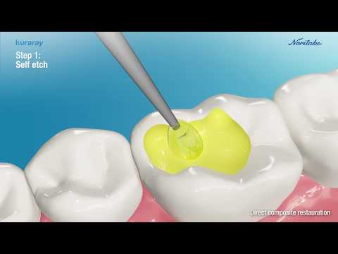Клеарфил Универсал бонд квик, Clearfil Universal Bond Quick 5 мл (Kuraray Noritake Dental) - фото 1 - id-p1436219352