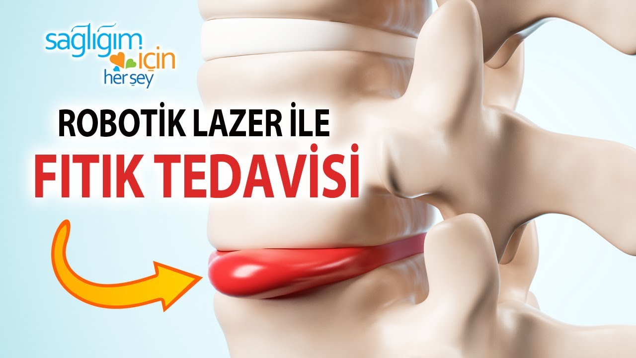 Robotik Lazer ile Fıtık Tedavisinin Avantajları