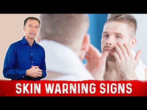 7 Skin Warning Signs of Diabetes