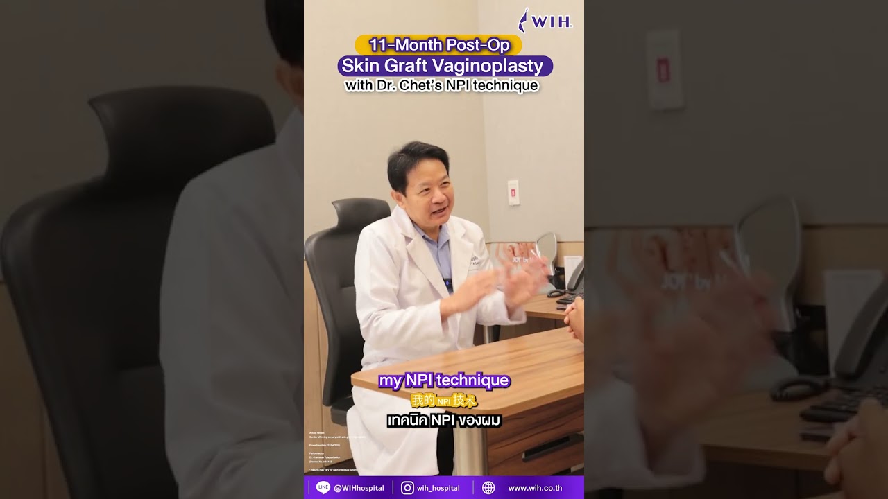 Stacy 11 month Gender affirming surgery with skin graft vaginoplasty by Dr. Chet’s NPI technique