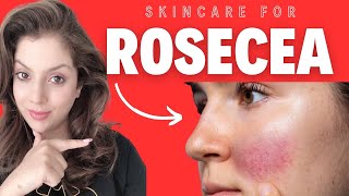 New Skincare Routine For Rosacea And Sensitive Skin!