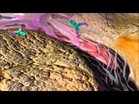 Abevmy 400 Mg Injection