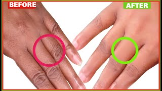 #1 How To Make Your Hands Look 5 Years Younger | get wrinkle free smooth clear hands