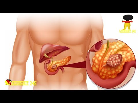 Antihypertensive Therapie bei Patienten mit Diabetes mellitus Medizinische Geräte für die Behandlung von Diabetes