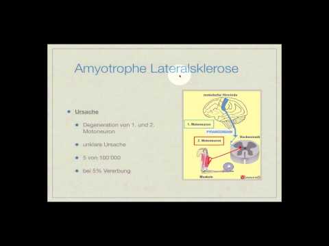 Hypertension Schritt 1 Schritt 2 R 3 Für hypertensive Krise verwendet