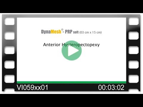 DynaMesh®-PRP visible 03 cm x 15 cm - OR Video: Anterior Hysteropectopexy