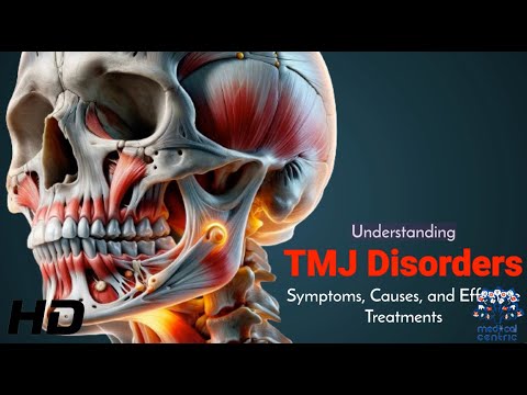TMJ Disorders Decoded: Expert Insights into Symptoms & Relief