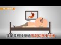 胃癌小心8大症狀警訊　遠離10大危險因子