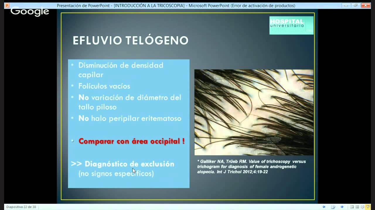 INTRODUCCION A LA TRICOSCOPIA: ALOPECIAS