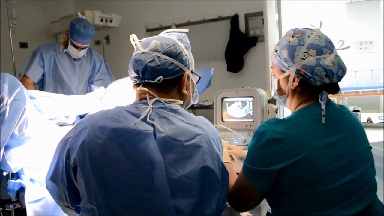 Watch Procedimiento de aspiración de folículos para fertilización InVitro en HCC Now Procedimiento de aspiración de folículos para fertilización InVitro en HCC