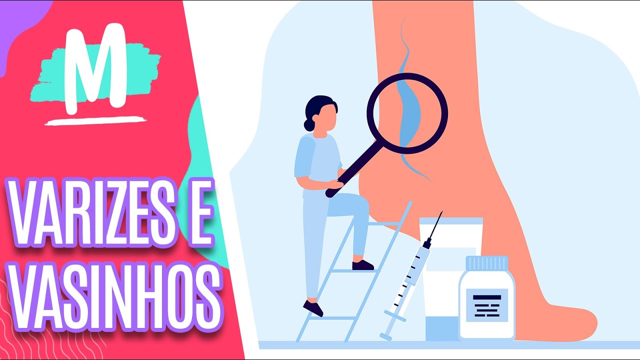 Saiba mais sobre VARIZES E VASINHOS! - Mulheres (07/03/23)