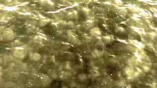 ANALGESIA - MAX EIDER