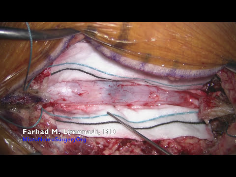 Periarthritis gemeinsamen ICD-Code Medikamente zur Behandlung der Kniearthrose von 2 Grad