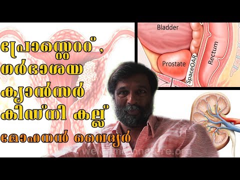 Prostatitis guidelines 2021