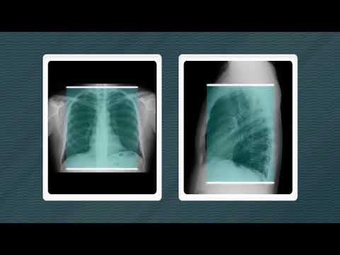 Tomografia do Tórax Rotina 01