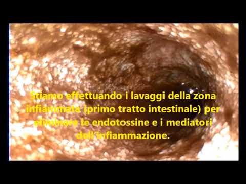 Catena di toro di vermi Che esso è migliore per portare parassiti di un organismo