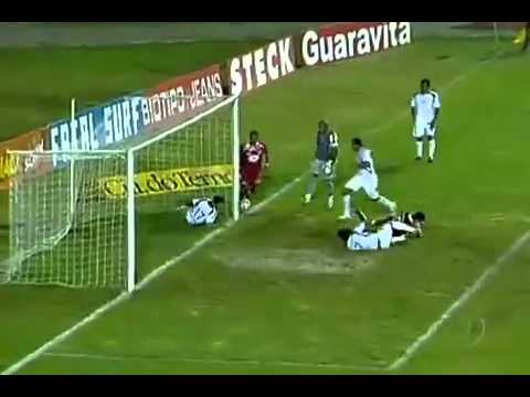 Jogador do Guaratinguetá leva chute no rosto ao tentar salvar gol