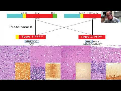 AANP Teaching Rounds - February 23 - Prions for Neuropathy Fellows (and Friends)